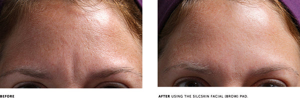 SILCSKIN FACIAL PADS {BROW SET}