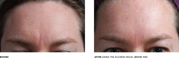 SILCSKIN FACIAL PADS {BROW SET}