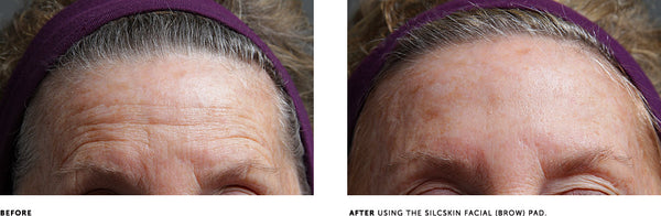 SILCSKIN FACIAL PADS {BROW SET}