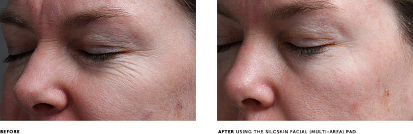 SILCSKIN FACIAL PADS {BROW SET}