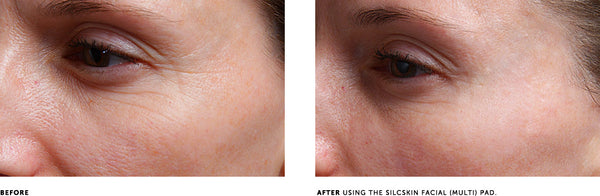 SILCSKIN FACIAL PADS {BROW SET}