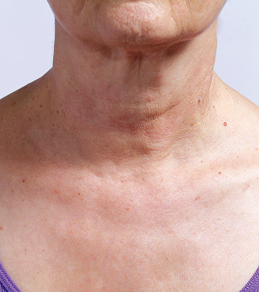 SILCSKIN COLLETTE PAD {FOR THE NECK}
