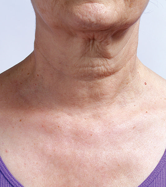 SILCSKIN COLLETTE PAD {FOR THE NECK}