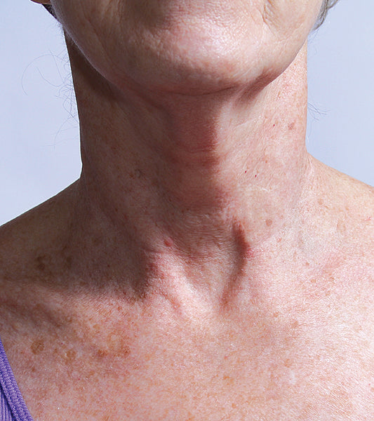 SILCSKIN COLLETTE PAD {FOR THE NECK}
