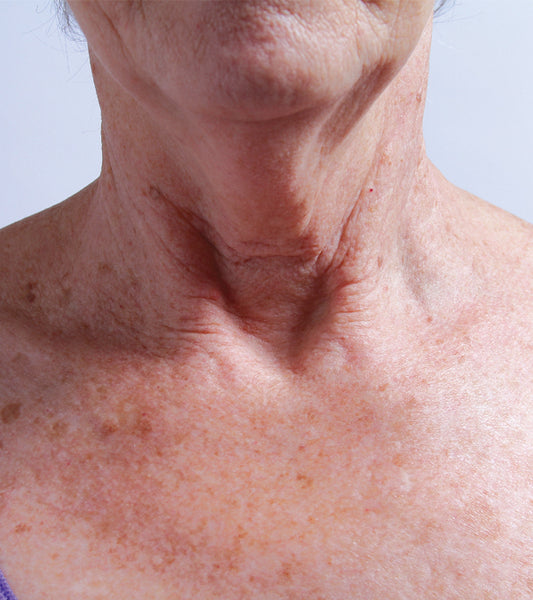 SILCSKIN COLLETTE PAD {FOR THE NECK}